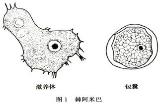 疾病百科 棘阿米巴性角膜炎 疾病介绍 导致眼部感染的阿米巴原虫