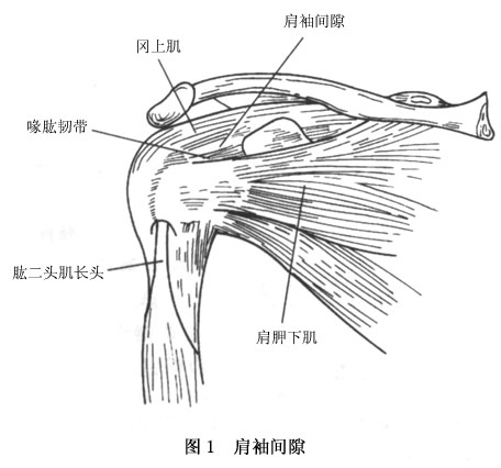 喙突外侧,肩胛下肌和冈上肌之间的肌间隙称肩袖间隙(rotator interval