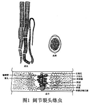 裂头绦虫病