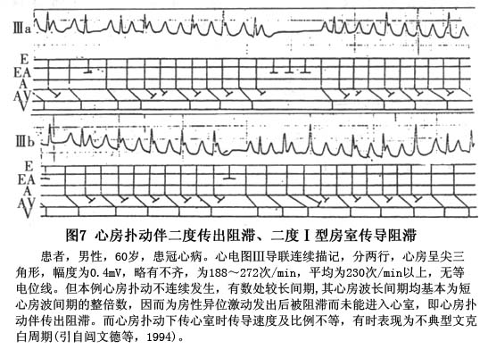 房扑