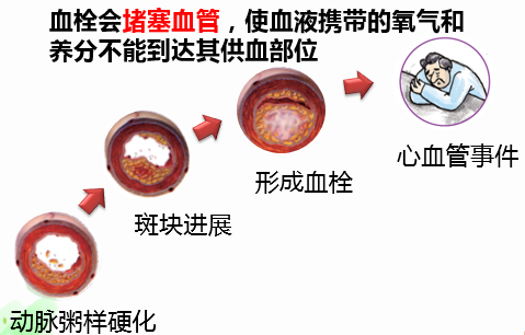 心中有数不用怕,正确认识心血管疾病风险
