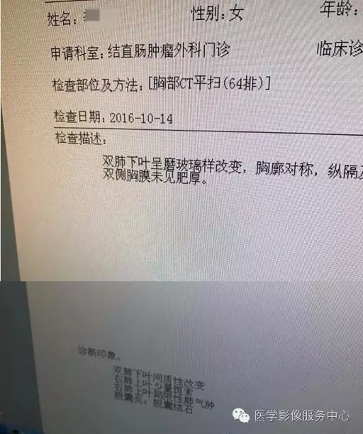 一份ct报告,引起了纠纷!