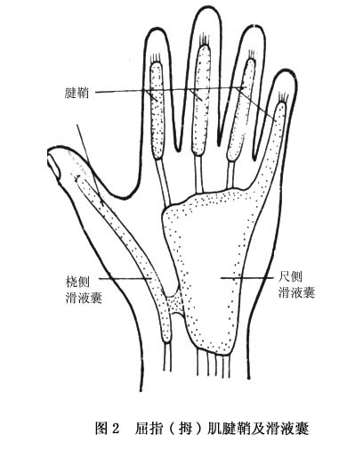 手部屈指肌腱损伤概述 病因 诊断 治疗 预防 微医 挂号网